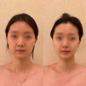 [경북 울진] 셀스테틱 경북울진점