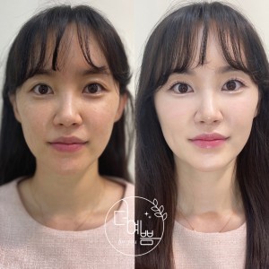 체험단 이미지