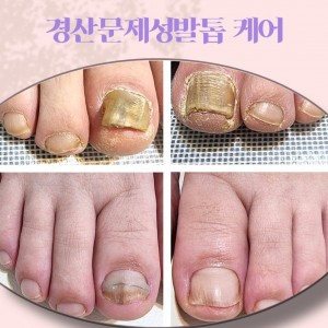 [경북 경산] 치유네일 닥터아이티엔 경산사동점