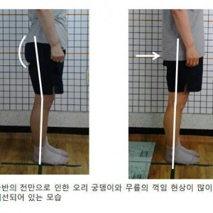 [울산 남구] 조창혁체형교정센터