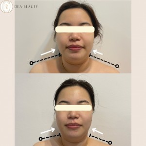 [경남 김해] 디아뷰티 김해점