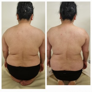 [경기 고양] 금손 체형관리&바디테라피