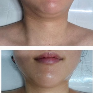 청담뷰티센터 덕계