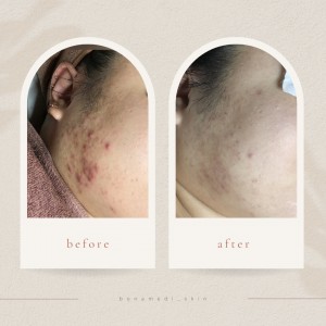 보나메디스킨&보나헤어살롱