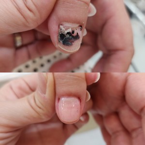 디에고푸스 위례점 네일어베인