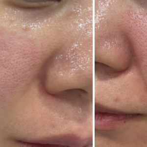 지아뷰티앤스킨