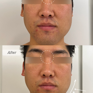 [경기 광주] 안테라피