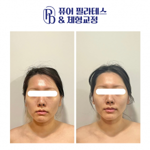 퓨어 필라테스&체형교정