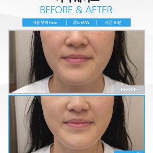 [경기 광주] 루미에스떼 경기광주점