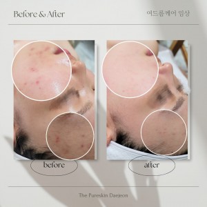 [대전 서구] 더맑은스킨 대전관저점