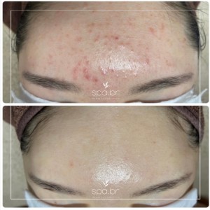 [서울 영등포] 스파비알