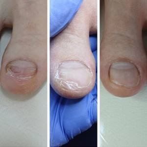 [경기 하남] 리뉴얼풋케어