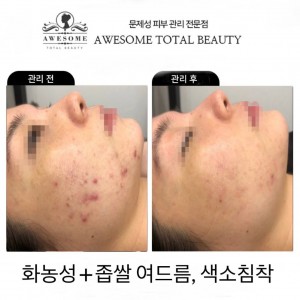 [경남 창원] 어썸뷰티에스테틱