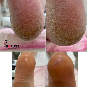 [서울 서초] 네일리코 레푸스 반포점