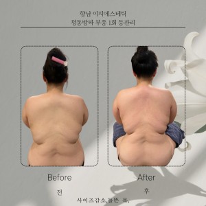 [경기 화성] 이지에스테틱