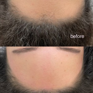 [대구 달성] 해바뷰티 눈썹&왁싱