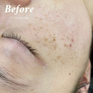 [서울 강서] Room110 스킨앤바디