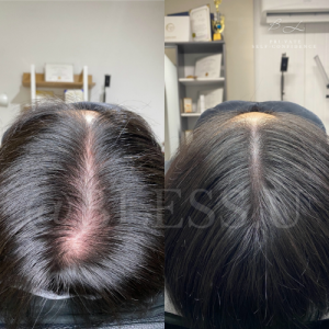 [서울 도봉] 블래스유