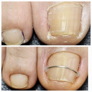 스페이스뷰티 파주운정점