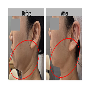 [경기 평택] 에스테틱 금손