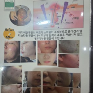 [부산 동래] 닥터힐럭스 뷰티뱅크 온천점