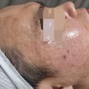 [경기 과천] 더마클리어센터 과천점