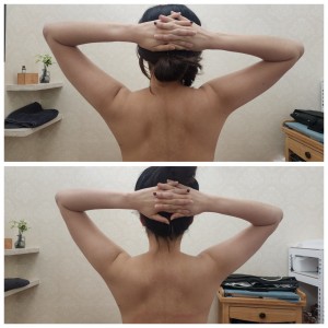 고아라스킨케어