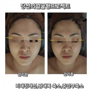 [충남 천안] 당신의얼굴형프로젝트