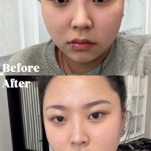 [충북 청주] 에스테틱숨결