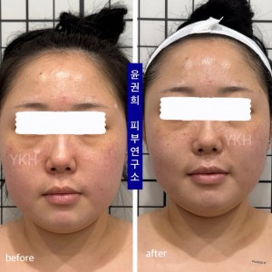 [부산 해운대] 윤권희 피부연구소