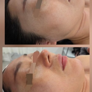 에끌라에스테틱