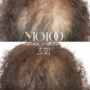 [인천 미추홀] 설레인라인