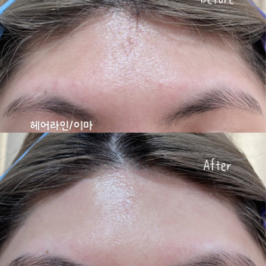 [서울 송파] 라나왁싱