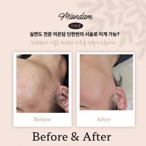 [대전 대덕] 미온담