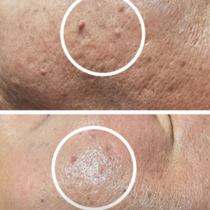 [강원 동해] 김서이피부연구소 / 서이테라피