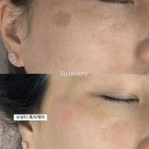 [경남 창원] 수앤유뷰티