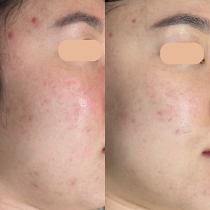 [대전 서구] 루틴에스테틱