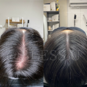 [서울 도봉] 블래스유