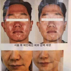 [경기 부천] 브이라인