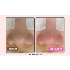 [경기 남양주] 블랙헤드 코피다 남양주점