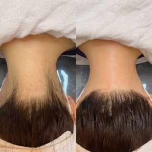 [경기 성남] HADA 왁싱