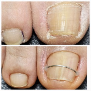 스페이스뷰티 파주운정점