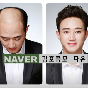 김호증모가발 다온헤어