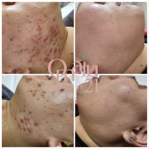 오마주 21 스킨케어