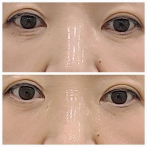 TLS 라라샵 지묘점