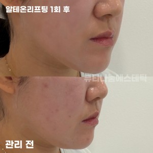 뷰티나눔에스테틱