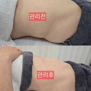 스무살에 머물다