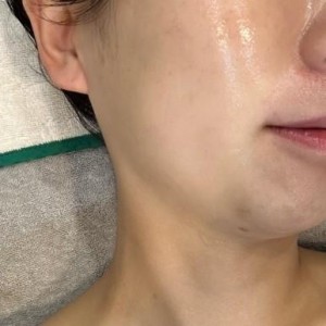 스킨엠디코스