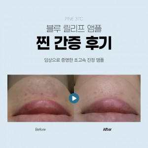 더맑은스킨 내포신도시점