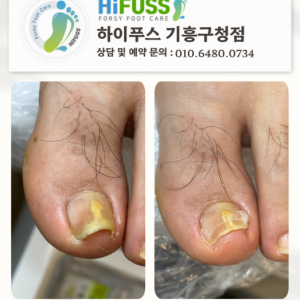 슬기로운네일 하이푸스 기흥구청점